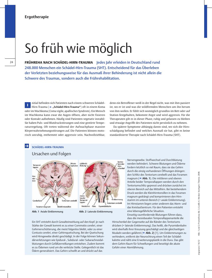 Vorschauseite 1: Frühreha nach Schädel-Hirn-Trauma ? So früh wie möglich