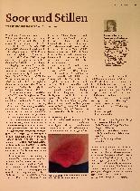 Vorschauseite 1: Soor und Stillen