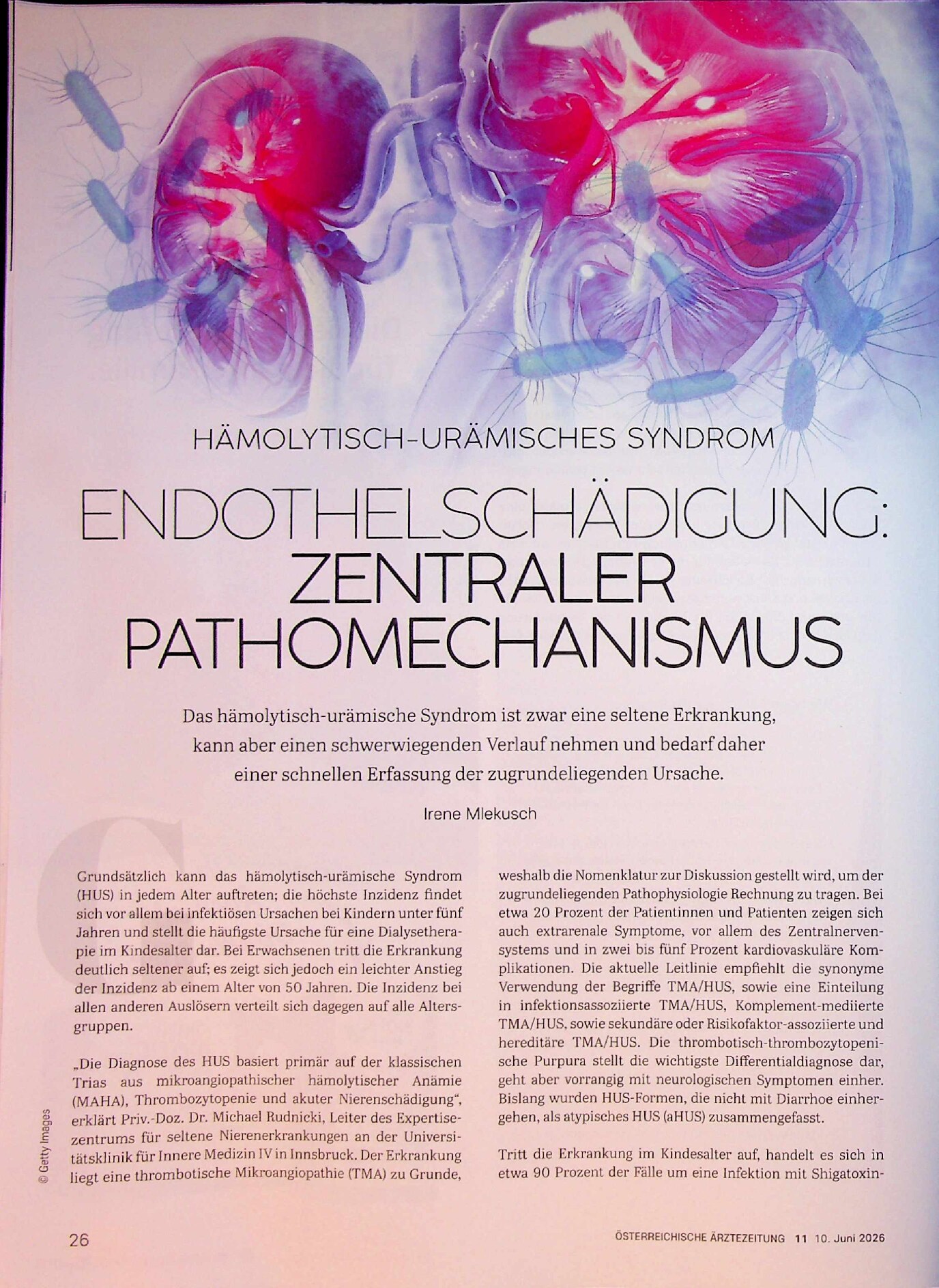Vorschauseite 1: Hämolytisch-urämisches Syndrom: Endothelschädigung zentraler Pathomechanismus