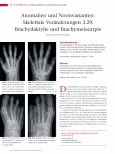 Vorschauseite 1: Anomalien und Normvarianten: Skelettale Veränderungen 3.29: Brachydaktylie und Brachymetacarpie