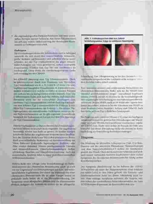 Vorschauseite 3: Rhinosinusitis