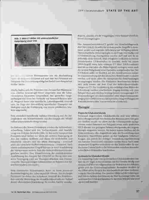 Vorschauseite 4: Rhinosinusitis