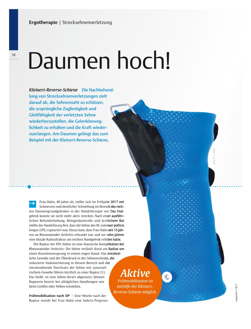 Vorschauseite 1: Kleinert-Reverse-Schiene ? Daumen hoch!