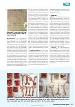 Vorschauseite 4: Vergleich der Anhaftung von Prüfanschmutzungen zur Ermittlung der Reinigungswirksamkeit bei wiederverwendbaren chirurgischen Instrumenten