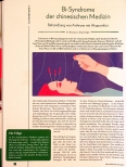Vorschauseite 1: Bi-Syndrom in der chinesischen Medizin: Behandlung von Arthrose mit Akupunktur
