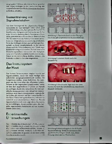 Vorschauseite 2: Komplementäre Parodontitis-Therapie: Zahnheilkunde trifft Erfahrungsmedizin