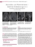 Vorschauseite 1: Anomalien und Normvarianten – Zerebrale Veränderungen 4.4 Kolpozephalie und partielle Balkenagenesie