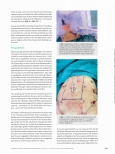 Vorschauseite 4: Robotik in der Viszeralchirurgie