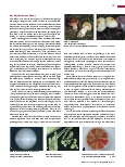 Vorschauseite 2: Pilze im Darm (Teil 1) - Freunde oder Feinde