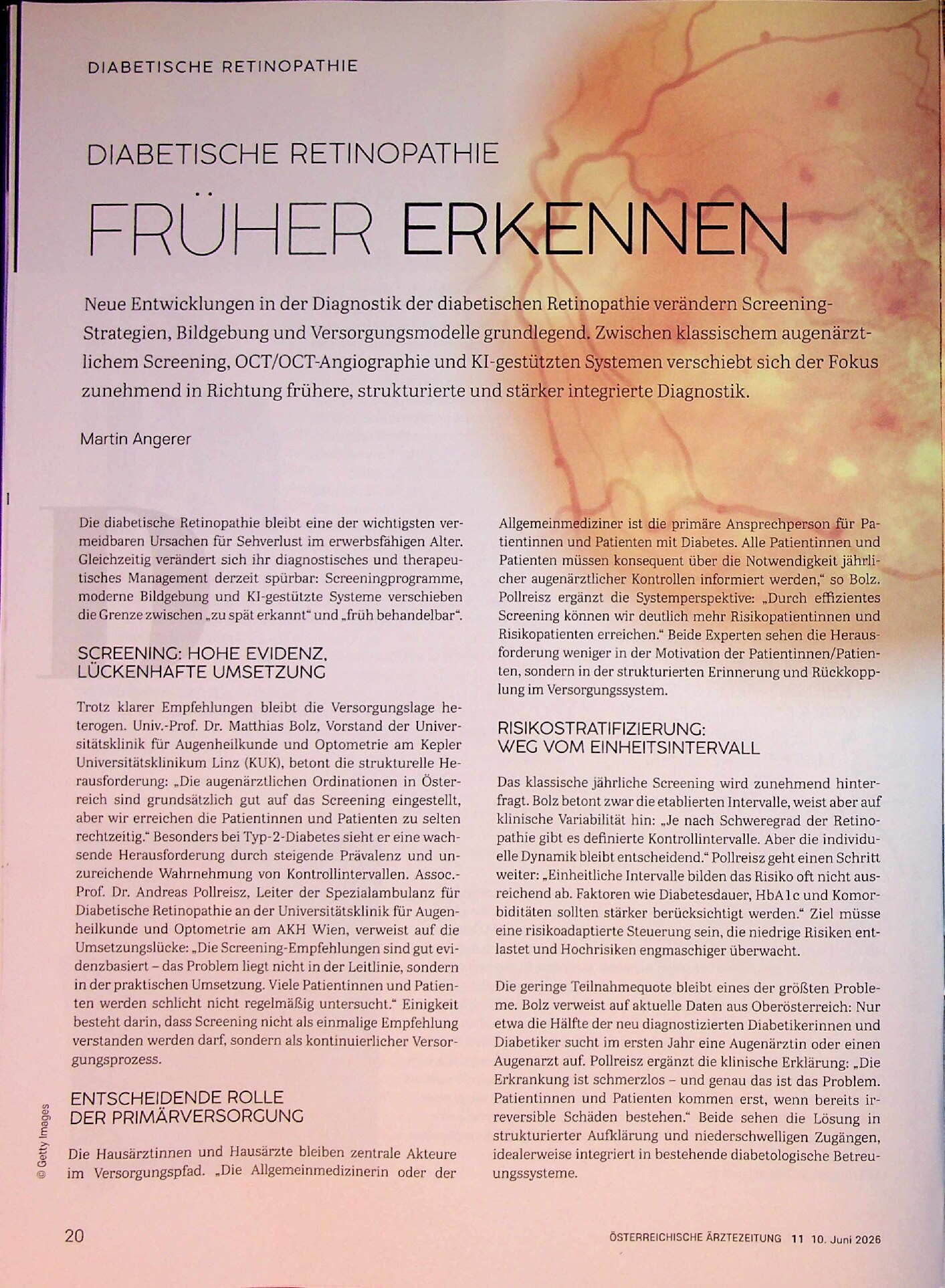Vorschauseite 1: Diabetische Retinopathie: Früher erkennen