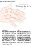 Vorschauseite 1: Rheumatoide Arthritis