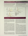 Vorschauseite 3: Immuntherapeutika: Nebenwirkungen und deren Management