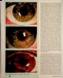 Vorschauseite 4: Kann man Krebs im Auge sehen? Ein Deutungsversuch.