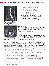 Vorschauseite 1: Anomalien und Normvarianten - Skelettale Veränderungen 3.34: Wirbelverkürzung