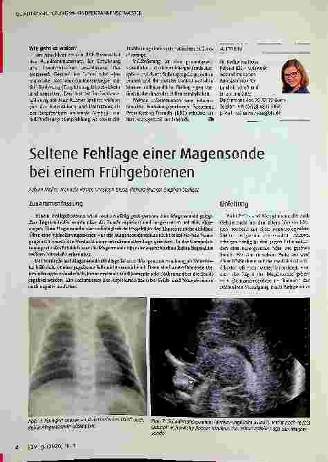 Vorschauseite 2: So wird Deutschland stillfreundlich - Ergebnisse und Empfehlungen des Forschungsvorhabens Becoming Breastfeeding Friendly (BBF)