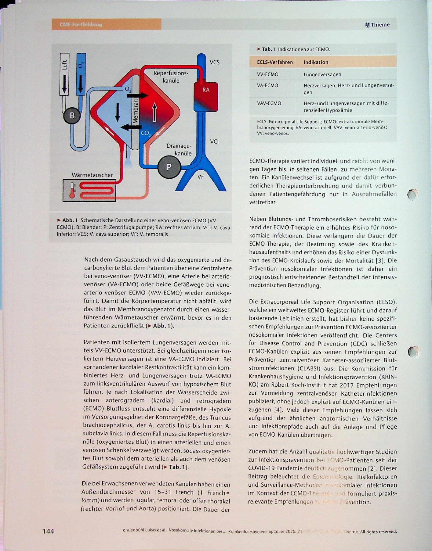 Vorschauseite 2: Nosokomiale Infektionen bei ECMO-Therapie – Ursachen, Prävention und Surveillance