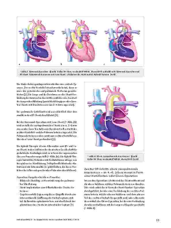 Vorschauseite 4: Das hypoplastische Linksherzsyndrom