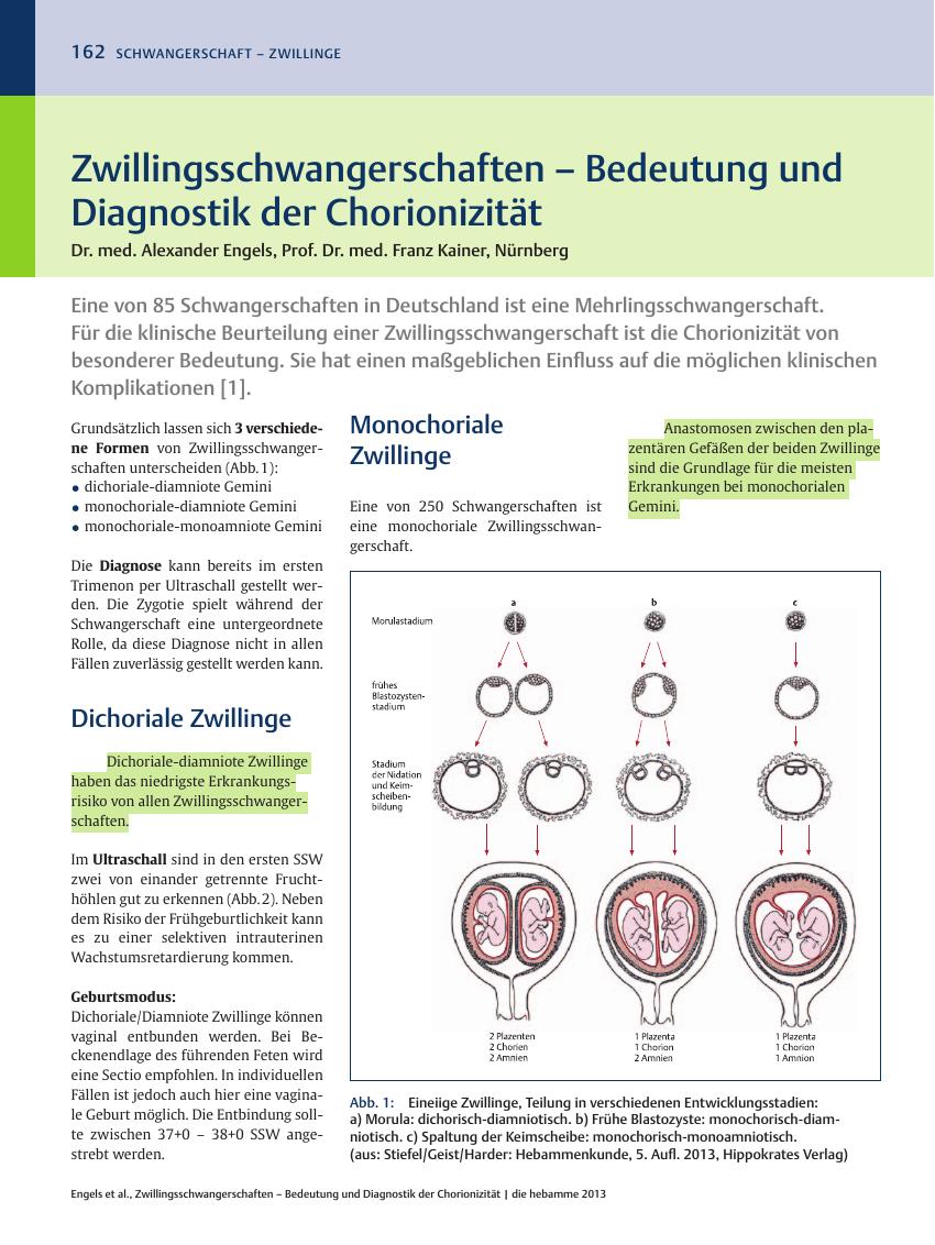 Vorschauseite 1: Zwillingsschwangerschaften ? Bedeutung und Diagnostik der Chorionizität