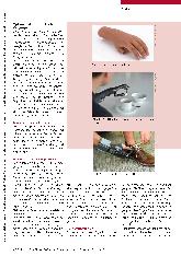 Vorschauseite 2: Innovative prothetische Intervention für Menschen mit Teilhandamputation: Eigenkraftprothesen.