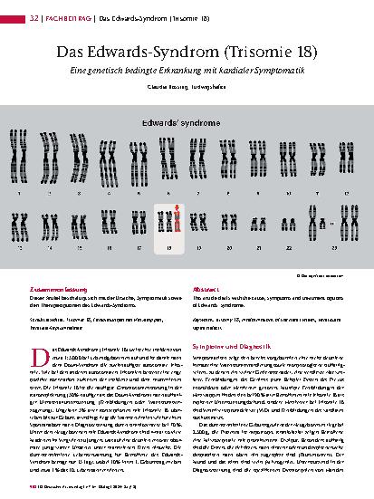 Vorschauseite 1: Das Edwards-Syndrom (Trisomie 18) ist eine genetisch bedingte Erkrankung mit kardialer Symptomatik.