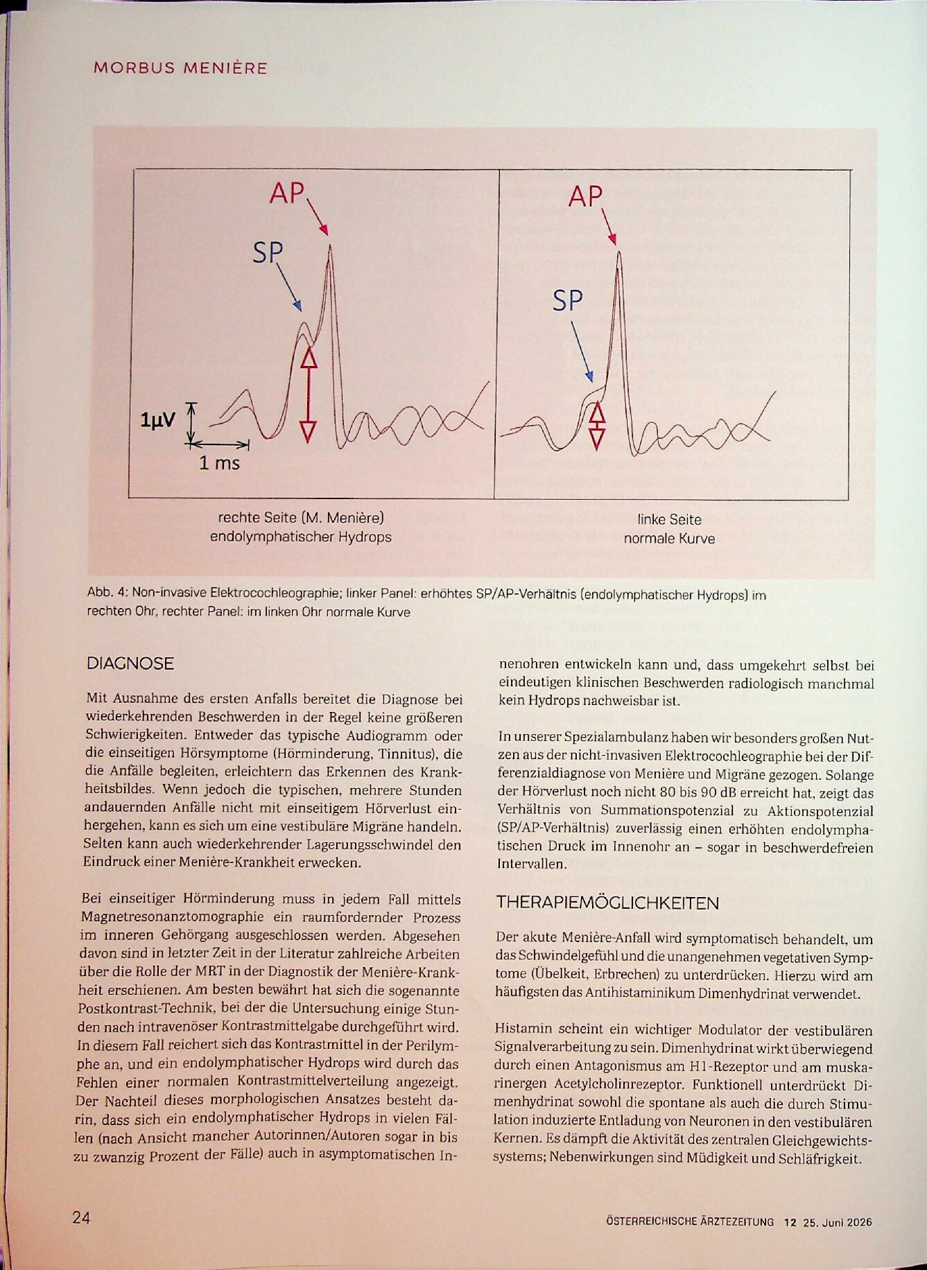 Vorschauseite 5: Morbus Menière
