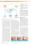 Vorschauseite 4: Alginate in der Wundtherapie: Eigenschaften und Verordnungsfähigkeit