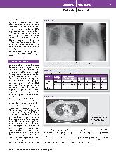 Vorschauseite 2: Boerhaave-Syndrom auf hoher See