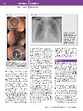 Vorschauseite 3: Boerhaave-Syndrom auf hoher See