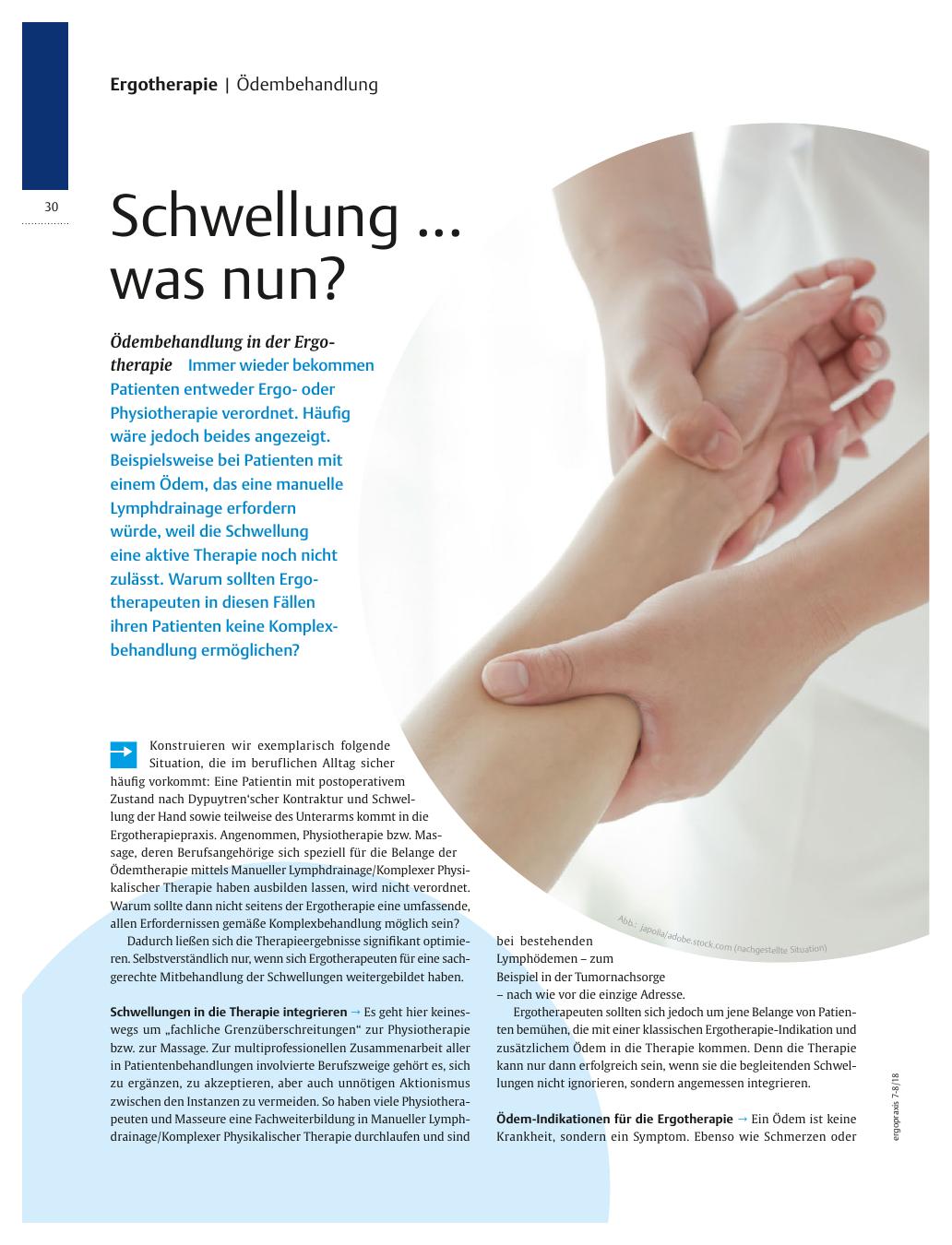 Vorschauseite 1: Ödembehandlung in der Ergotherapie? Schwellung? was nun?