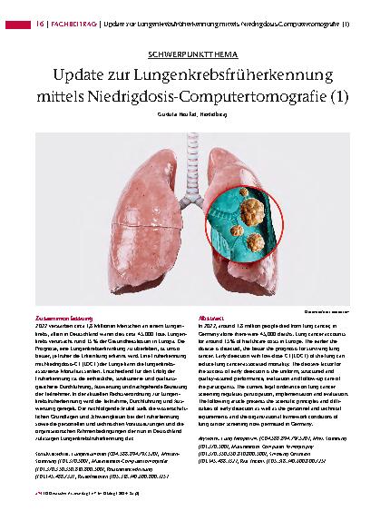 Vorschauseite 1: Update zur Lungenkrebsfrüherkennung mittels Niedrigdosis-Computertomografie (1)