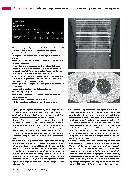 Vorschauseite 3: Update zur Lungenkrebsfrüherkennung mittels Niedrigdosis-Computertomografie (1)