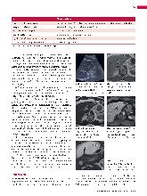 Vorschauseite 2: Anomalien und Normvarianten - Interne Veränderungen 2.19: Leberhämangiom