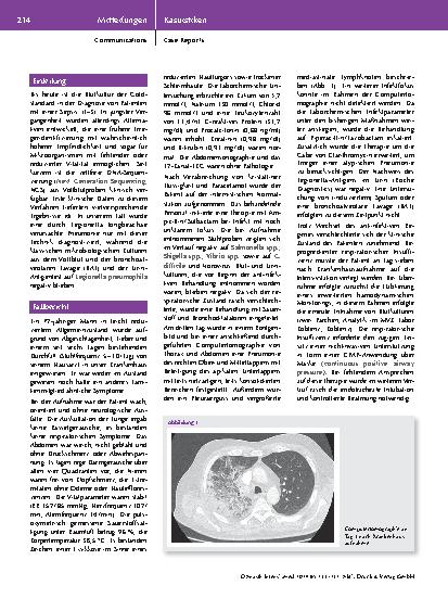 Vorschauseite 2: Diagnose einer atypischen Lungenentzündung durch Legionella longbeachae mit Hilfe der zellfreien bakteriellen DNA-Technologie aus Vollblut – Ein interessanter Fall