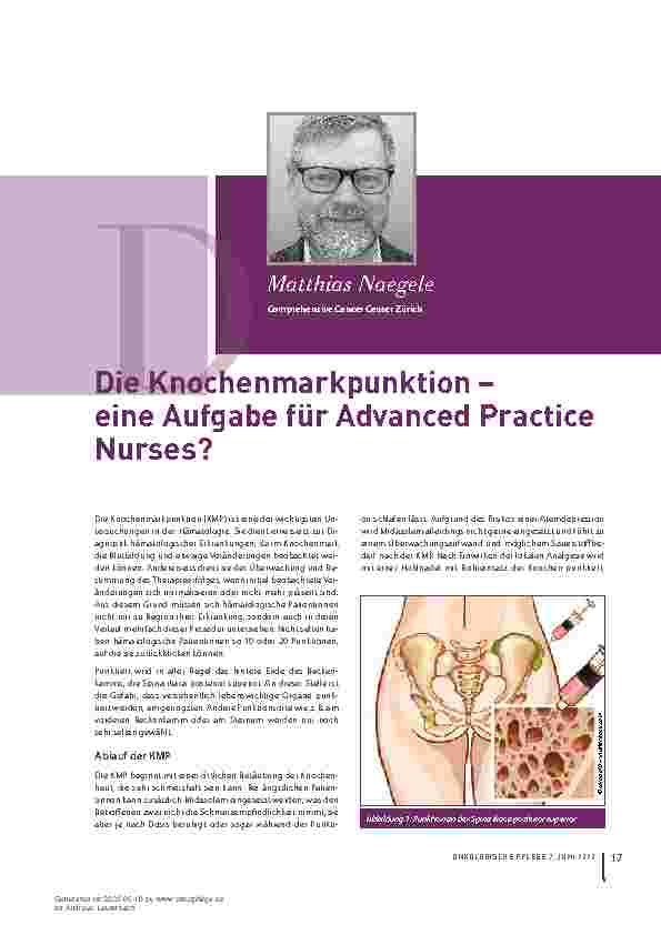 Vorschauseite 1: Die Knochenmarkpunktion - eine Aufgabe für Advanced Practice Nurses?