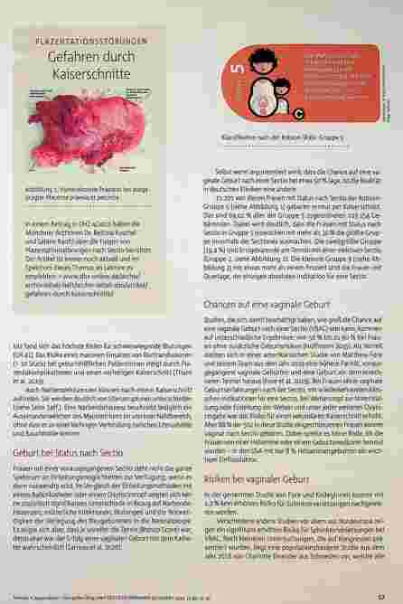 Vorschauseite 2: Kaiserschnitt - kein großes Ding, oder?