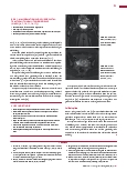 Vorschauseite 2: Anomalien und Normvarianten: Interne Veränderungen 2.12 Uterus bicornis