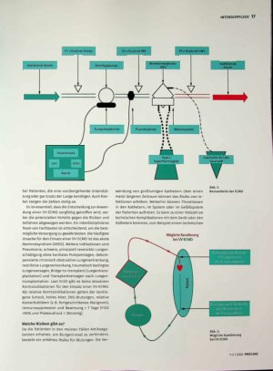 Vorschauseite 2: Hochmoderne Intensivpflege mit der ECMO