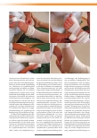 Vorschauseite 4: Manuelle Lymphdrainage und Kompression als Standardbehandlung des Lymphödems