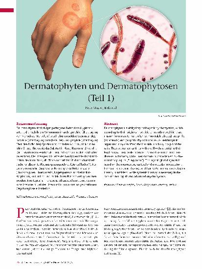 Vorschauseite 1: Dermatophyten und Dermatophytosen (Teil 1)