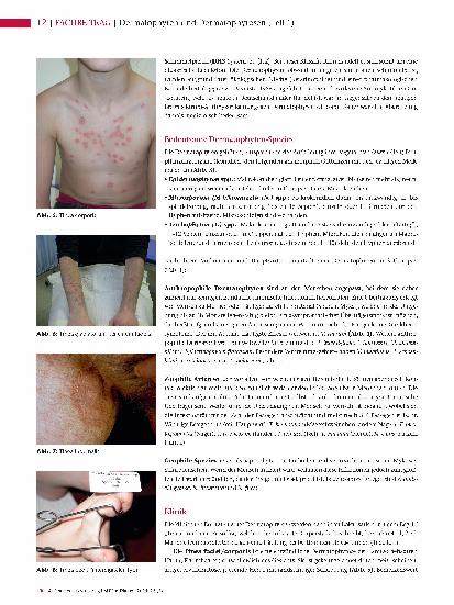 Vorschauseite 3: Dermatophyten und Dermatophytosen (Teil 1)