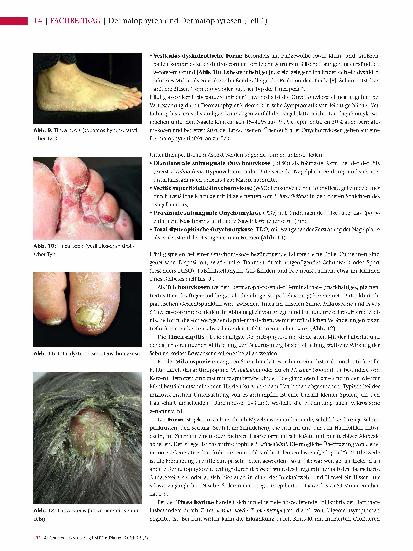 Vorschauseite 5: Dermatophyten und Dermatophytosen (Teil 1)