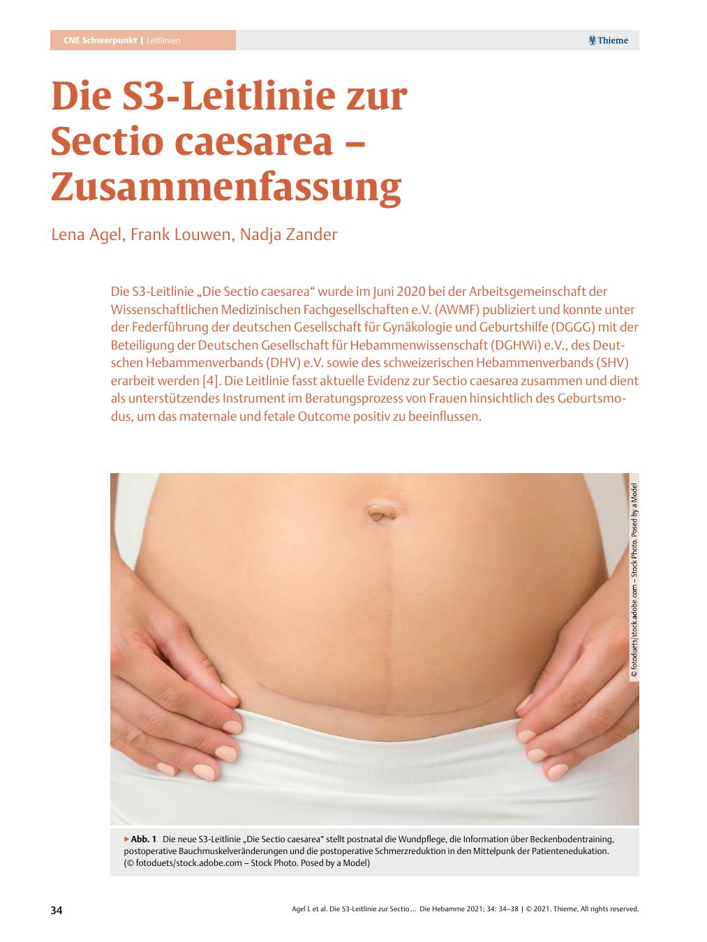 Vorschauseite 1: Die S3-Leitlinie zur Sectio caesarea – Zusammenfassung