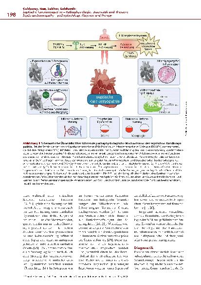 Vorschauseite 3: Septische Kardiomyopathie – Pathophysiologie, Diagnostik und Therapie