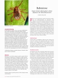 Vorschauseite 1: Babesiose: Durch Zecken übertragbare seltene Infektion mit Blutschmarotzern