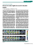 Vorschauseite 1: Prismenadaptationstherapie bei Neglekt: Klinisch relevante Ergebnisse aus drei aktuellen Studien