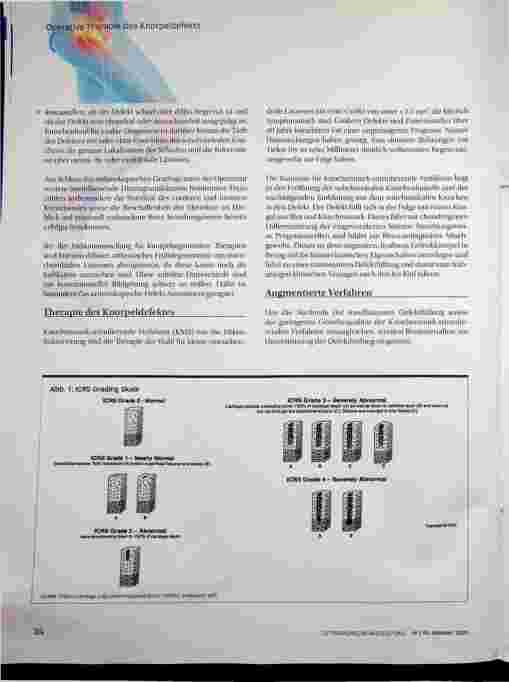 Vorschauseite 3: Operative Therapie des Knorpelsdefekts