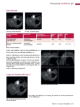 Vorschauseite 4: CT-Protokolle CT-Angiografie – Vena subclavia