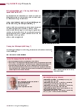 Vorschauseite 5: CT-Protokolle CT-Angiografie – Vena subclavia