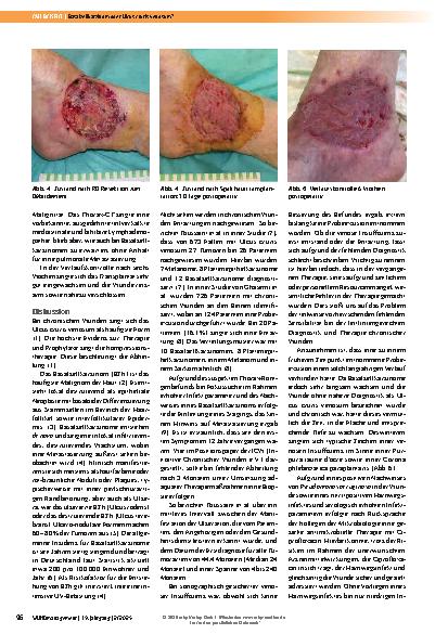 Vorschauseite 3: Basalzellkarzinom oder Ulcus cruris venosum?