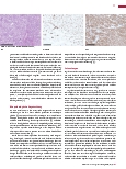 Vorschauseite 2: Die Nieren-Immunhistochemie hilft bei der Differenzialdiagnose.
